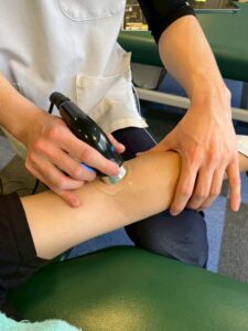 腕へコンビネーション施術をしている写真