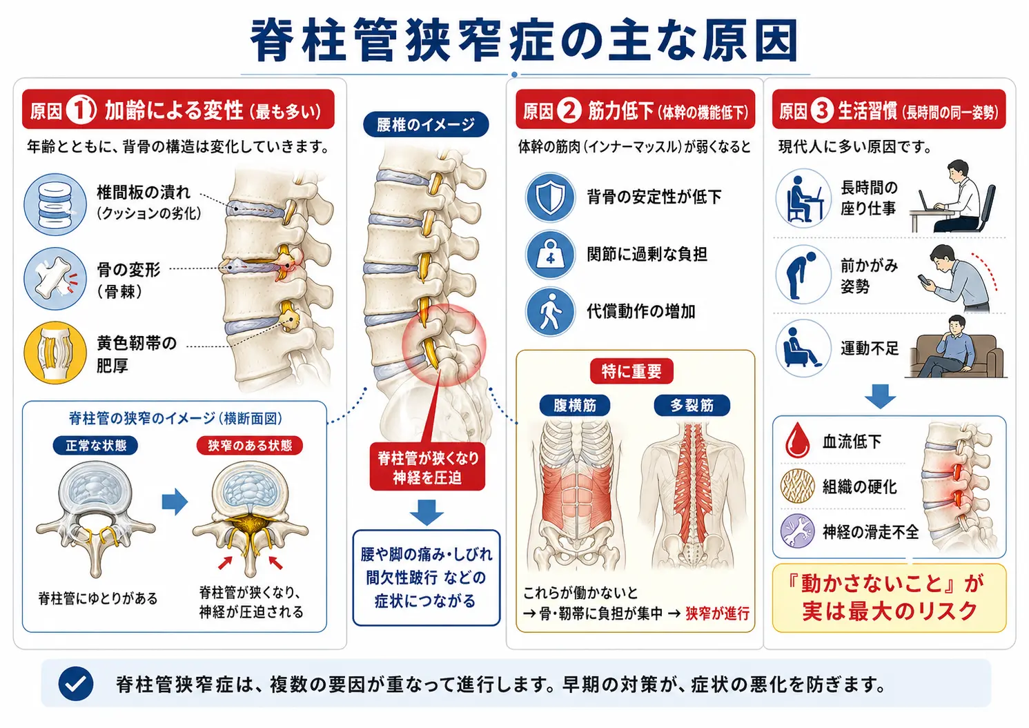 八王子で脊柱管狭窄症の原因を説明する画像 多摩鍼灸整骨院 京王八王子院