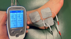 電気刺激による痛みの軽減施術｜八王子みなみ野の整骨院