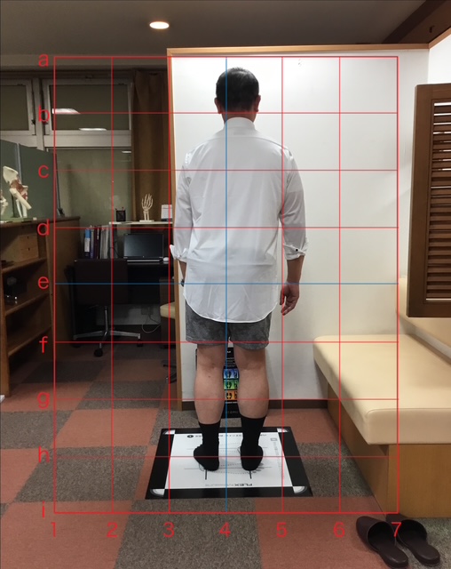 姿勢や身体のバランスを確認する検査イメージ|八王子みなみ野の整骨院