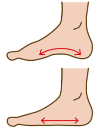 シンスプリント画像