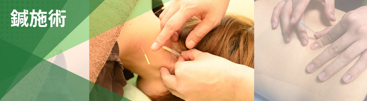 多摩整骨院の鍼施術｜首の筋肉へ鍼治療を行う様子